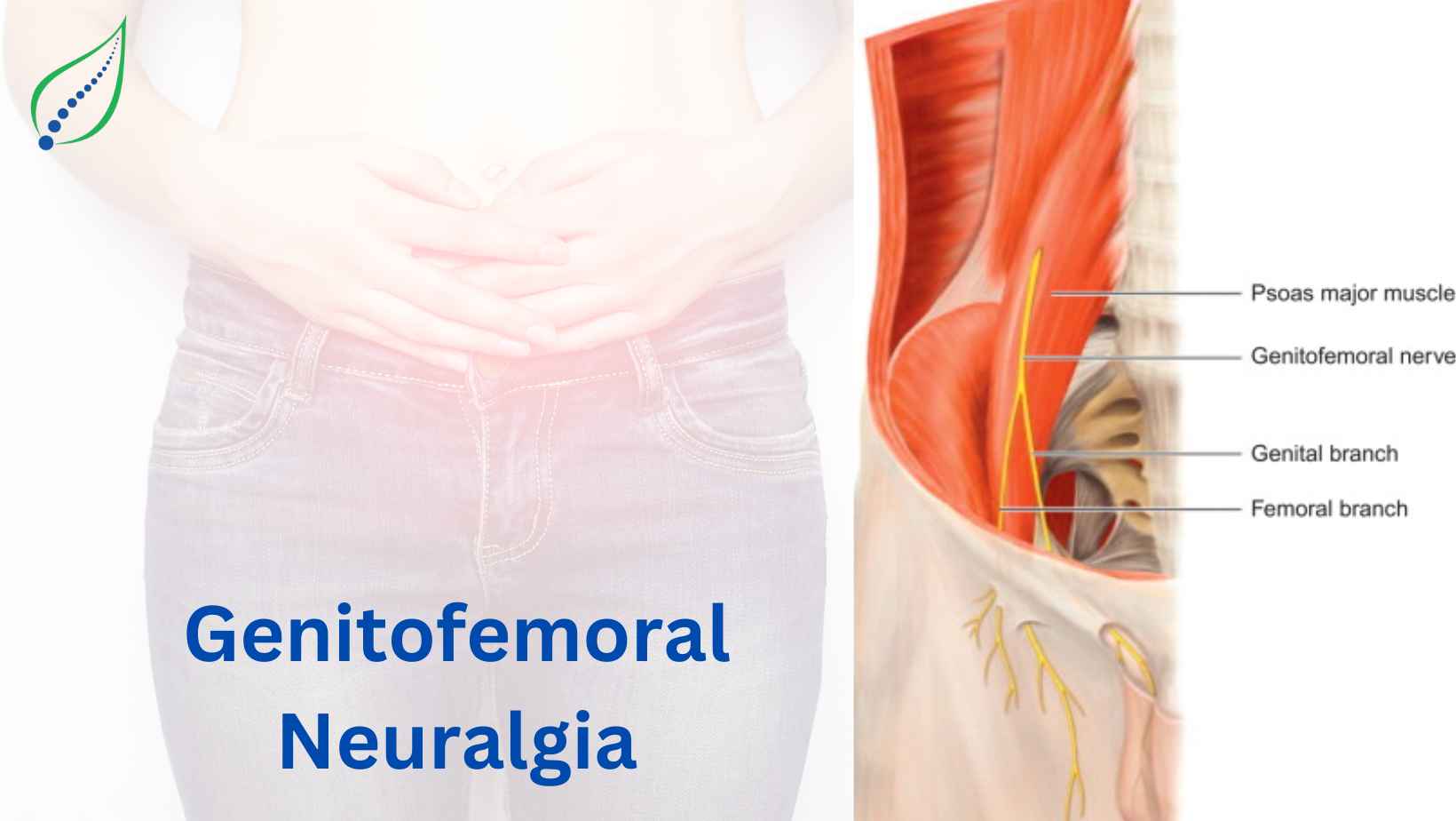 Genitofemoral Neuropathy